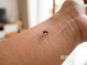 Nyamuk Aedes aegypti hitam belang putih hinggap di kulit lengan, foto dekat